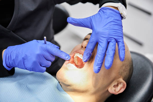 Best Emergency Dental Care for Sports Injuries in Seaford, DE