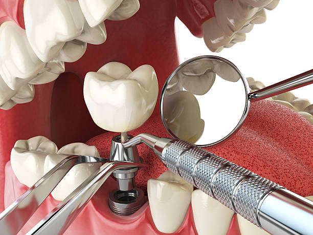Best Dental Abscess Treatment in Seaford, DE